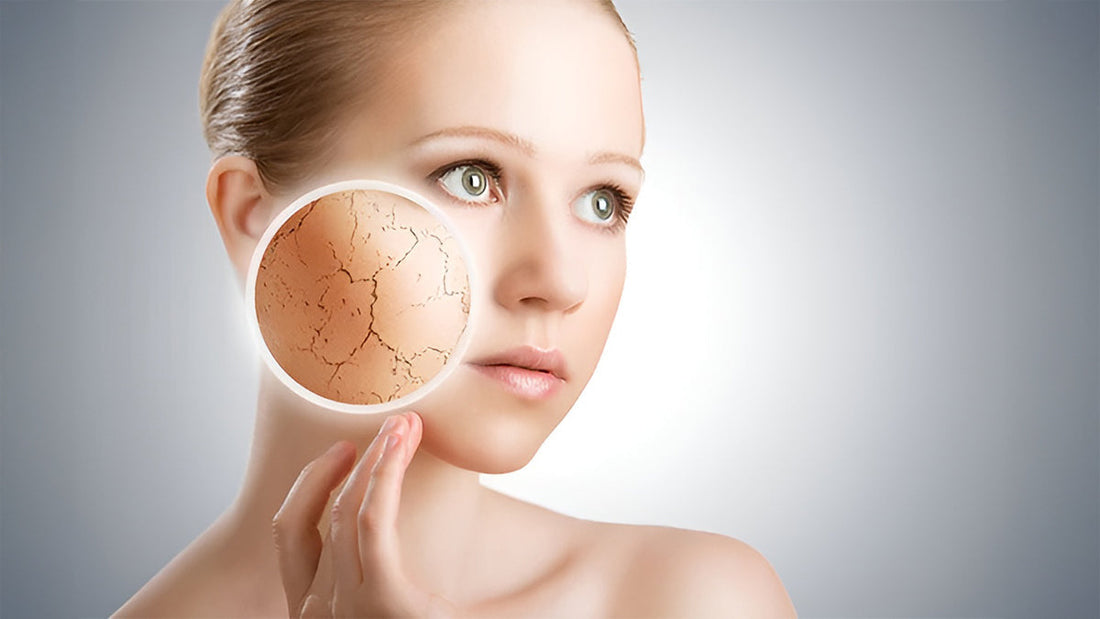 Why Does Skin Stay Dry Even After Moisturising?