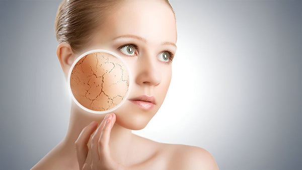 Why Does Skin Stay Dry Even After Moisturising?