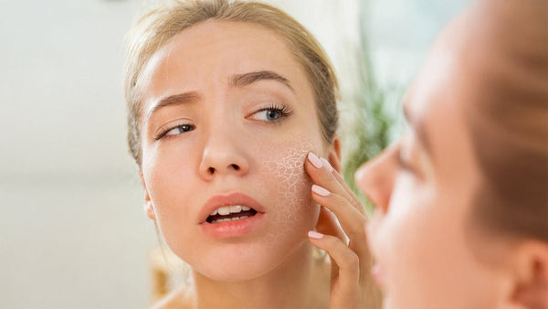 Why Your Skin Gets Dry Even If You Drink Enough Water (Scientific Reasons)